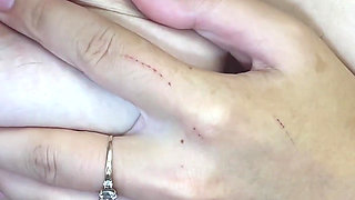 Pulling Hair with Tweezers on Natural Tits!