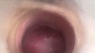 Extraordinary Cervix Pump Sounding And Peehole Have fun